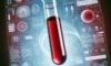 Vitamin B12 Blood Test Guide for Residents of Bridlington